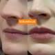 Плампер для губ з мікроголками VT COSMETICS Reedle Shot Lip Plumper Beginner 4.3 г - зображення 3