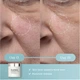 Пади для пілінгу обличчя Elemis Dynamic Resurfacing Facial Pads 14 шт - зображення 2