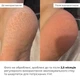 Увлажняющие носки для пят Hillary HydraHeel Soft Socks гелевые носки для ухода за кожей стоп увлажняющие. (652850) - изображение 2