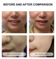 Secret Strips Anti-Wrinkle Smile Line Patches — пластыри для лица с сывороткой для лифтинга и обновления кожи, 10 шт. + 8 мл - изображение 4