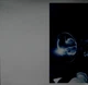 Chet Baker - It Could Happen To You - Chet Baker Sings (180 грамм, Раскладная обложка, Альбом, Переиздание) - изображение 3