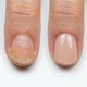 RESULTUM Nail Polish Hardener S.O.S + Calcium & Vitamins Зміцнювач бежевий, 11 мл - зображення 8