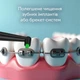 Насадка для зубной щетки Pecham - 643732 - изображение 5