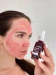 Кислотна сироватка-пілінг для обличчя HOLLYSKIN Glycolic Acid - зображення 2
