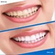 Відбілювальні смужки для зубів Smilekit 3D White Teeth AND 5510, набір 14 пакетиків, засіб для домашнього відбілювання - зображення 6