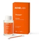 Подсушивающий лосьон ACNELAB+ Dryspot Dry lotion 30 мл (4823109413054) - изображение 3