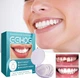 Накладные зубы Snap-On Veneers Временные виниры, накладка для улыбки - изображение 2