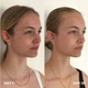 Спрей-очищувач для шкіри Clinisoothe+ Skin Purifier 100 ml - зображення 3
