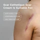 Крем для зменшення рубців Scar Esthetique 10 мл - зображення 2