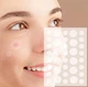 Набір пластирів від прищів та бородавок Acne Patch 72 шт - зображення 1