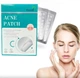 Набір пластирів від прищів та бородавок Acne Patch 72 шт - зображення 2