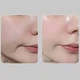 Киснева есенція з пептидами для еластичності шкіри Medi-Peel Peptide 9 Volume All In One Essence 100 ml - зображення 3