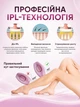 Лазерный эпилятор женский фотоэпилятор портативный безболезненный допашний фотоэпилятор Schwarz&Mayer флеш-лазерный фото эпилятор для лица и тела для домашнего использования розовый - изображение 7