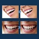 М’який пластик для тимчасового протезування зубів EELHOE Temporary Tooth 30 мл — пластилін для зубів та творчості - зображення 5