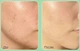 Пилинг–сыворотка со спикулами и центеллой Medi-Peel Phyto Cica-Nol B5 6000 Shot Serum 50 г - изображение 4