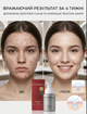 Сыворотка микропенная с AHA,BHA,PHA-кислотами VT Cosmetic AZ AHA RED MICRO BUBBLE SERUM 70 ml - изображение 5