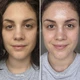 Засіб для сяючої шкіри Alpha-H Liquid Gold Exfoliating Treatment with 5% Glycolic Acid - зображення 2