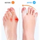 Ортопедический корректор для пальцев ног Hallux Valgus — силиконовый фиксатор большого пальца стопы, разделитель пальцев, бандаж от косточки (136115513) - изображение 4