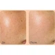 Освітлююча сироватка для обличчя з PDRN і глутатіоном Medi-Peel Young Cica PDRN Exo-pin Glutathione Serum 50 мл - зображення 3