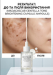 Сыворотка осветляющая для лица SKIN1004 Madagascar Centella Tone Brightening Capsule Ampoule 50 мл (8809913830627) - изображение 2