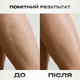 Вакуумный массажер для тела антицеллюлитный Cupping Massage Pro — массажер от целлюлита, 6 режимов, аккумулятор, черный - изображение 5