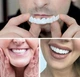 Многоразовые накладки на зубы Snap On Smile Veneers, универсальные виниры для зубов съемные, комплект на 2 челюсти, безопасные, белые - изображение 10