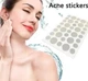 Пластырь от бородавок, натоптышей и папиллом Acne Patch, 72 шт, устраняют зуд и шелушение на коже, гидроколлоидный, лечебный - изображение 2