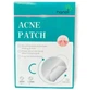 Пластырь от бородавок, натоптышей и папиллом Acne Patch, 72 шт, устраняют зуд и шелушение на коже, гидроколлоидный, лечебный - изображение 10