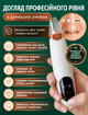Вакуумный очиститель пор чистящее устройство для удаления черных точек пилинг вакуумный массаж чистящий аппарат (WSC-03) - изображение 2