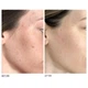 Салфетки для пилинга лица dr.dennis gross skincare alpha beta universal daily peel 3шт - изображение 4