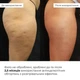 Комплекс разогревающих антицеллюлитных обертываний для тела Hillary Anti-Cellulite Pro 10 уп. HI-11-552 - изображение 5