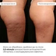 Антицеллюлитные обертывания с охлаждающим эффектом Hillary Anti-cellulite Bandage Cooling Effect HI-01-808 - изображение 4