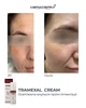 Осветляющий крем BRADERM Tramexal Cream, 30 мл 00-00000388 - изображение 5