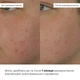 Крем для тела SPF 50+ Hillary Pigmentation Brightening 150 мл дерматокосметика - изображение 7