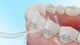 Іригатор Cecotec Bamba ToothCare 1100 Jet Liberty - зображення 9
