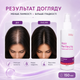 Спрей для волос против выпадения волос Hair Perfecta Средство для борьбы с выпадением волос 150 мл Спрей от выпадения волос - изображение 5