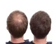 Загуститель для волос Toppik Hair Building Fibers (Auburn) Каштановый - изображение 5