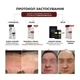 Освітлювальний крем BRADERM Tramexal Cream, 30 мл 00-00000388 - зображення 2