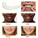 Знімні вініри Smile Veneers на дві щелепи, білі накладки на зуби для ідеальної усмішки - зображення 7