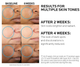 Сыворотка La Roche Posay Glycolic B5 с гликолевой кислотой от темных пятен 30 мл - изображение 3