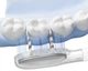 Насадки для електричної зубної щітки Laifen ProSS Gum Care (30102-000140) - зображення 5