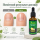 Противогрибковое средство Jaysuing 7Days Nail Fungus Treatment Уход за ногтями во время грибки, 30 мл Средство от грибка ногтей - изображение 6