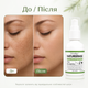 Крем для лица от пигментных Oveallgo NatureErase Instant Mole & Spot Cream Крем против пигментации, 50 мл Борьба с пигментаци - изображение 9
