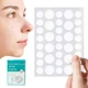 Лечебный пластырь от прыщей папиллом и бородавок Acne Patch патч - изображение 2