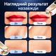 Фотоэпилятор IPL для женщин и мужчин с охлаждением Ice Cooling, 999 999 вспышек, 9 уровней мощности, 3 в 1, 2 насадки - изображение 6