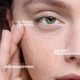 Ультраконцентрированная сыворотка для лица La Roche-Posay Effaclar Serum с эффектом пилинга, 30 мл - изображение 3