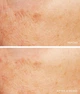 Пилинг для лица Lancer Caviar Lime Acid Peel with 10% Glycolic Acid + 10% Phytic Acid + Retinol 7.5 мл - изображение 2