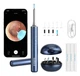 Умная ушная палочка Xiaomi Bebird Smart Ear Picker M9 S Blue - изображение 4