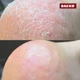 Крем-піна для ніг PEDIBAEHR CREMESCHAUM ROSE з 10% сечовиною, олією дамаської троянди, гіалуроновою кислотою та олією персика, для дуже сухої, огрубілої та потрісканої шкіри стоп, інтенсивне зволоження й відновлення, 125 мл - зображення 3