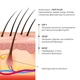 Энзимный трихологический пилинг для кожи головы Hillary Enzyme Trichological Scalp Peel, 120 мл HI-07-753 - изображение 3